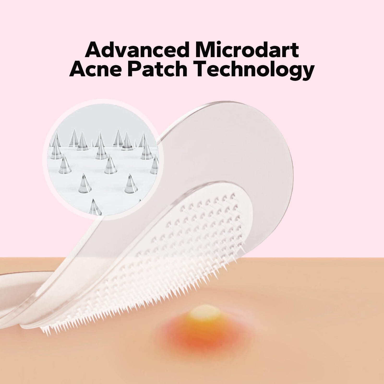 Close up view of microdart acne patches showing the hydrocolloid blemish spot texture.