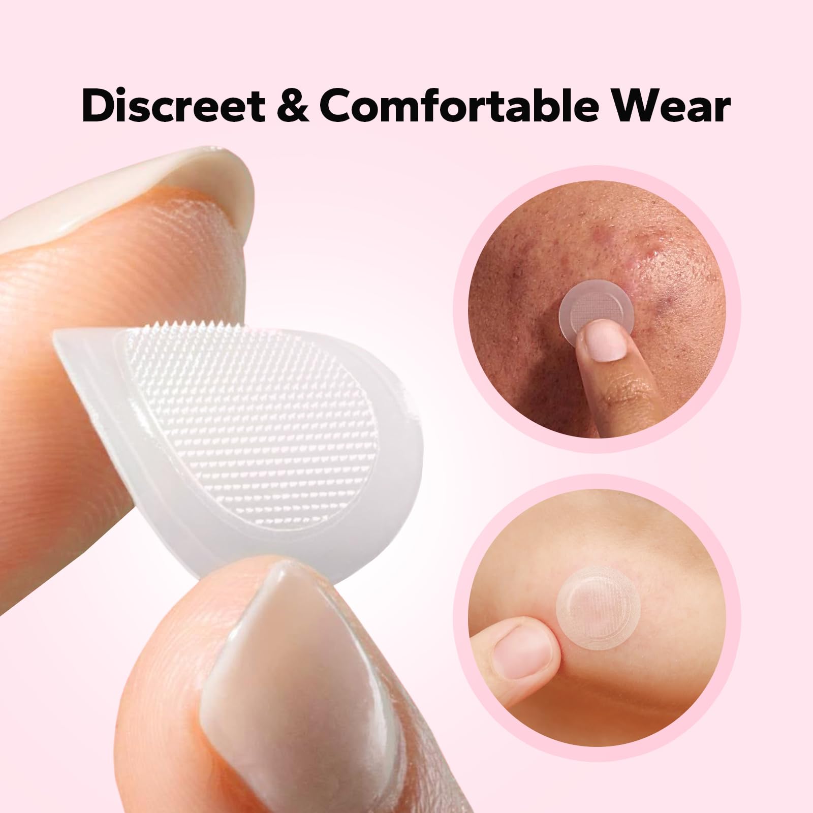 Skincare model demonstrating how to use dissolving microdart acne spot patches overnight.