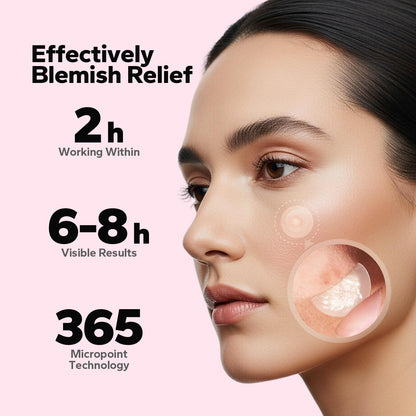 CharmCherry salicylic acid pimple patches packaging showing the 18 count quantity details.