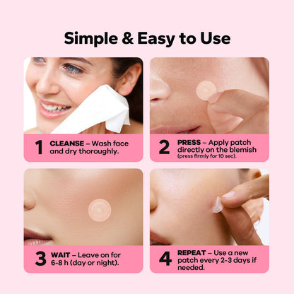 Infographic displaying the benefits of microdart technology for deep cystic acne breakouts.