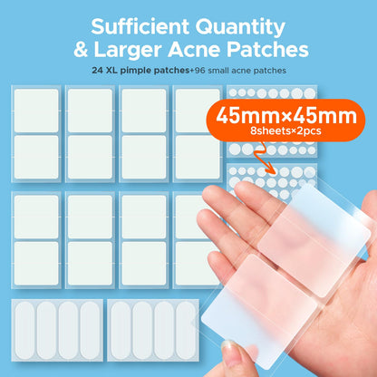 TKTK acne patches package interior displaying five different sizes of hydrocolloid stickers for body blemishes.