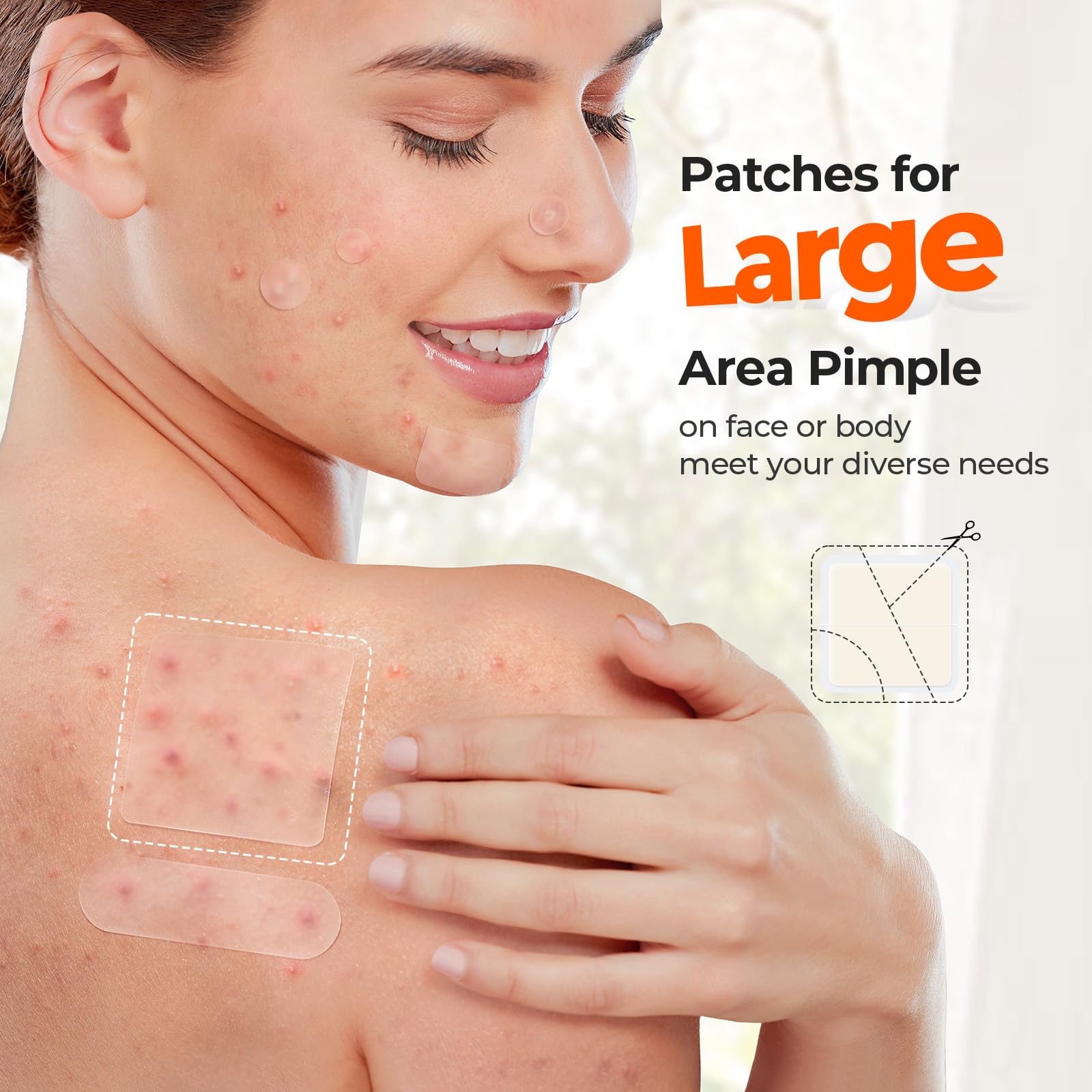 Extra large 45 by 45 millimeter square hydrocolloid bandage by TKTK applied to a clear back breakout zone.