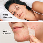 Close-up of TKTK XL acne patch absorbing fluid and turning white