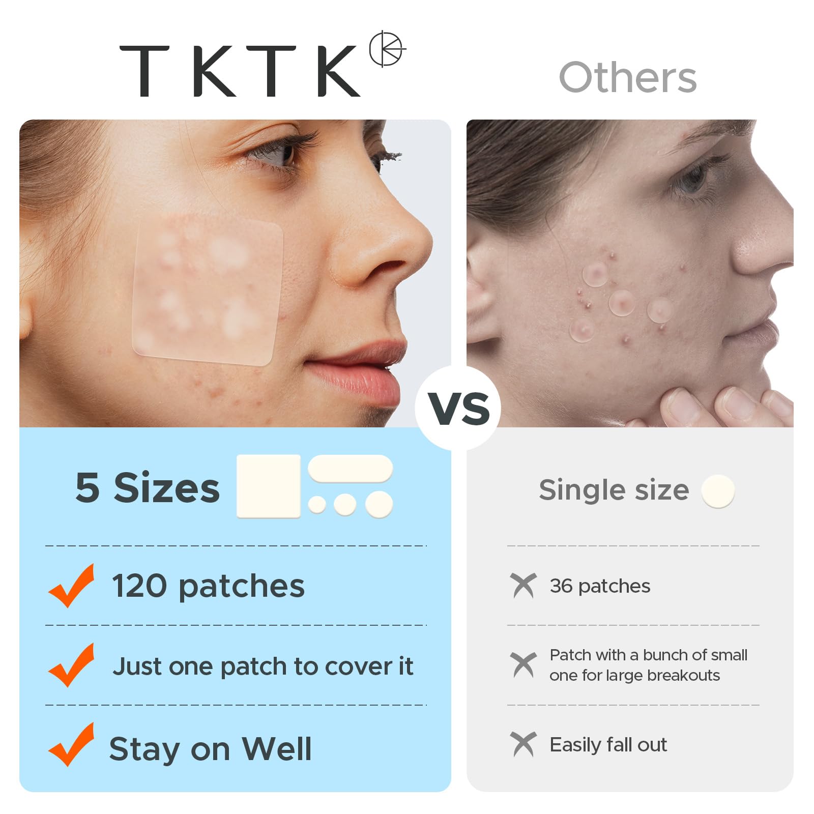 Before and after application demonstration of TKTK large pimple patch on a cheek whitehead breakout.
