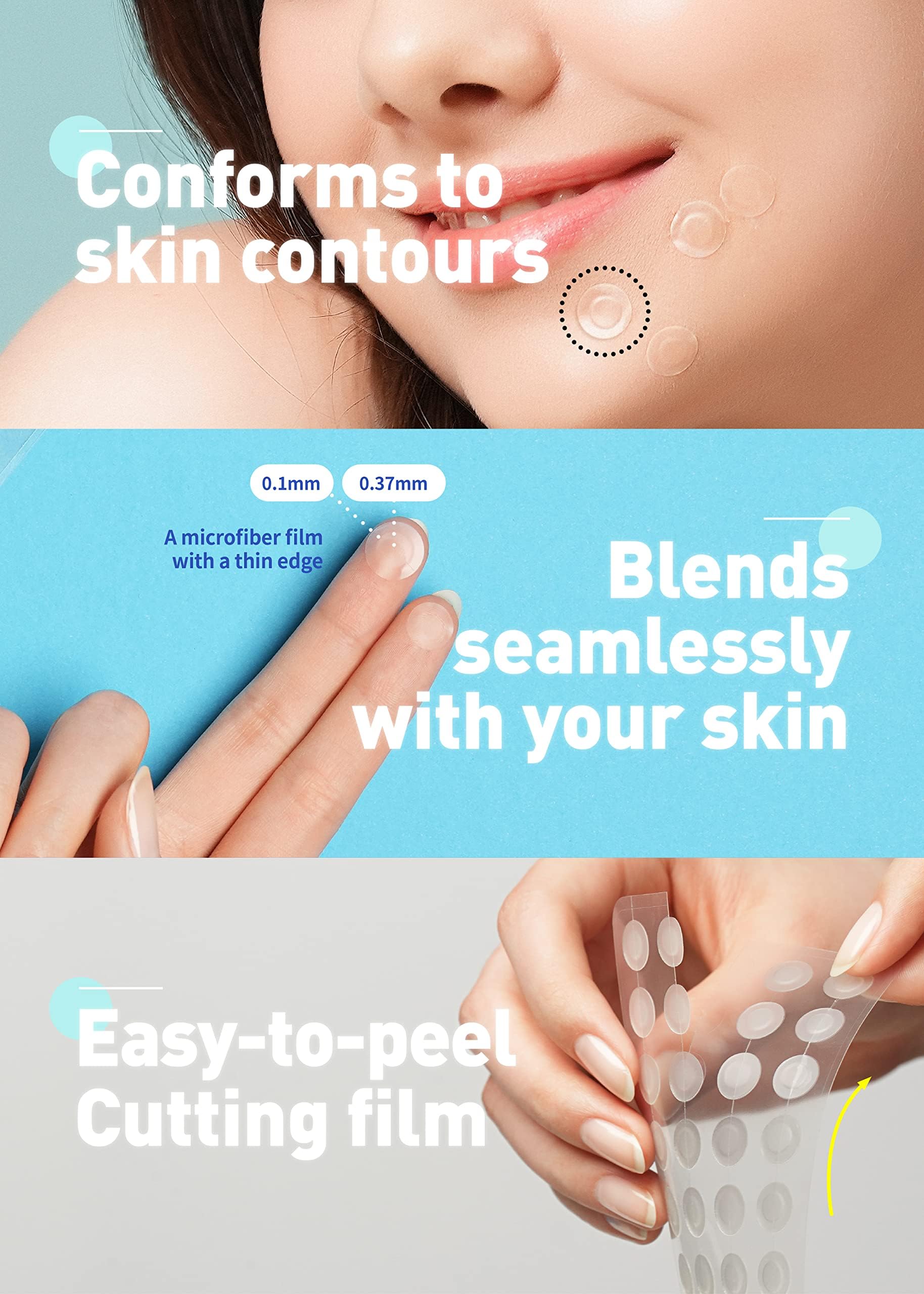 Korean hydrocolloid pimple patches absorbing impurities from a skin breakout