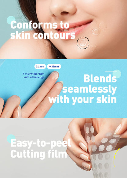 Korean hydrocolloid pimple patches absorbing impurities from a skin breakout