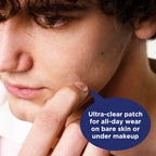 PanOxyl patches applied on skin invisibly