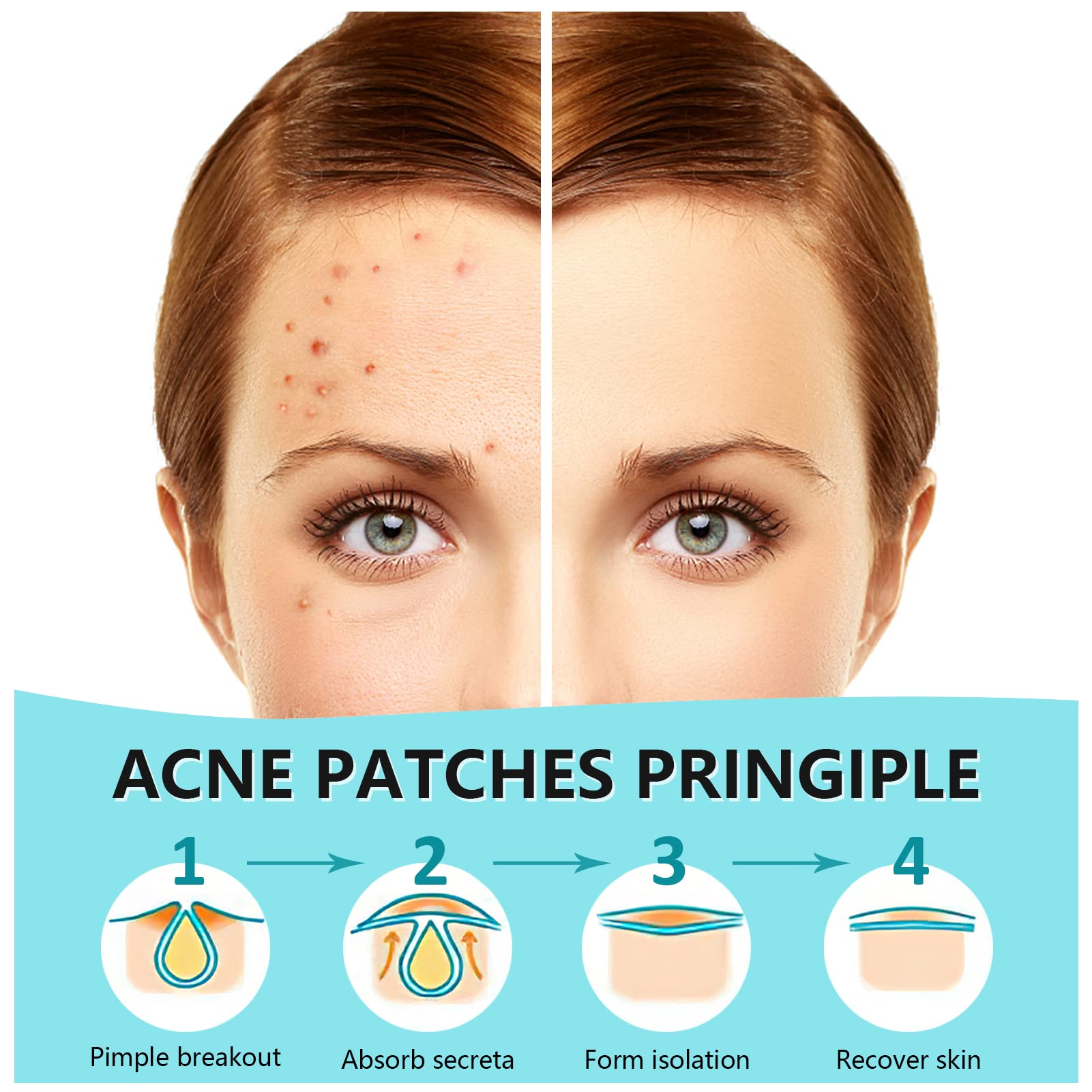PICcircuit pimple stickers display showing small and medium easy peel sheets for acne care.