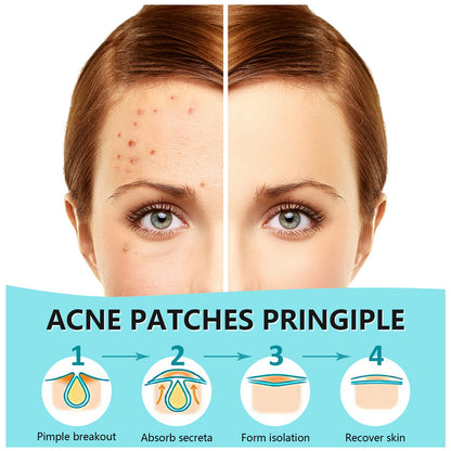 PICcircuit pimple stickers display showing small and medium easy peel sheets for acne care.