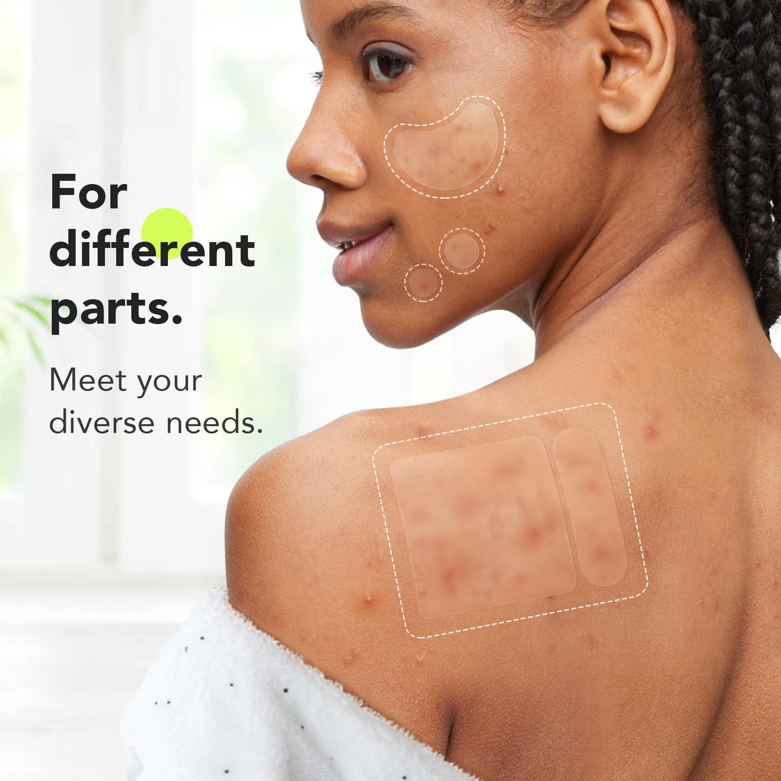 LitBear acne patches variety pack highlighting tea tree and calendula oil ingredients for blemish care.