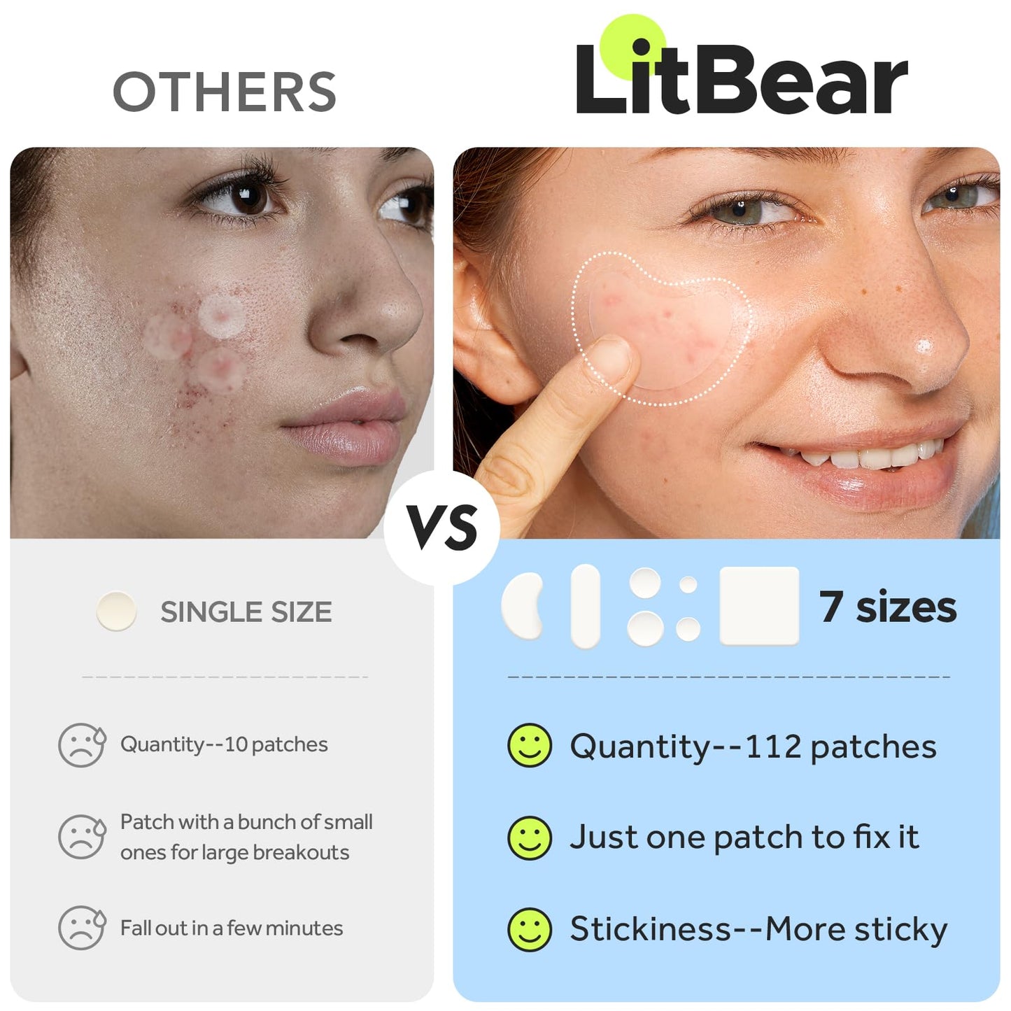 LitBear large medical grade hydrocolloid patch absorbing impurities from full body acne on the back.