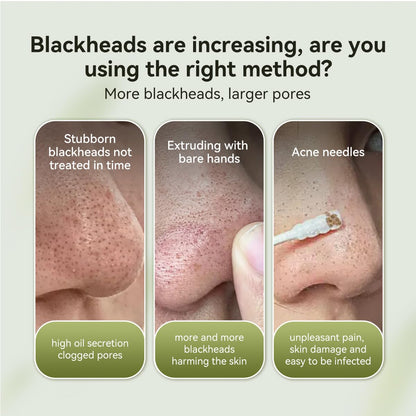 LANBENA blackhead removal mask paper sheets being peeled off to remove impurities.