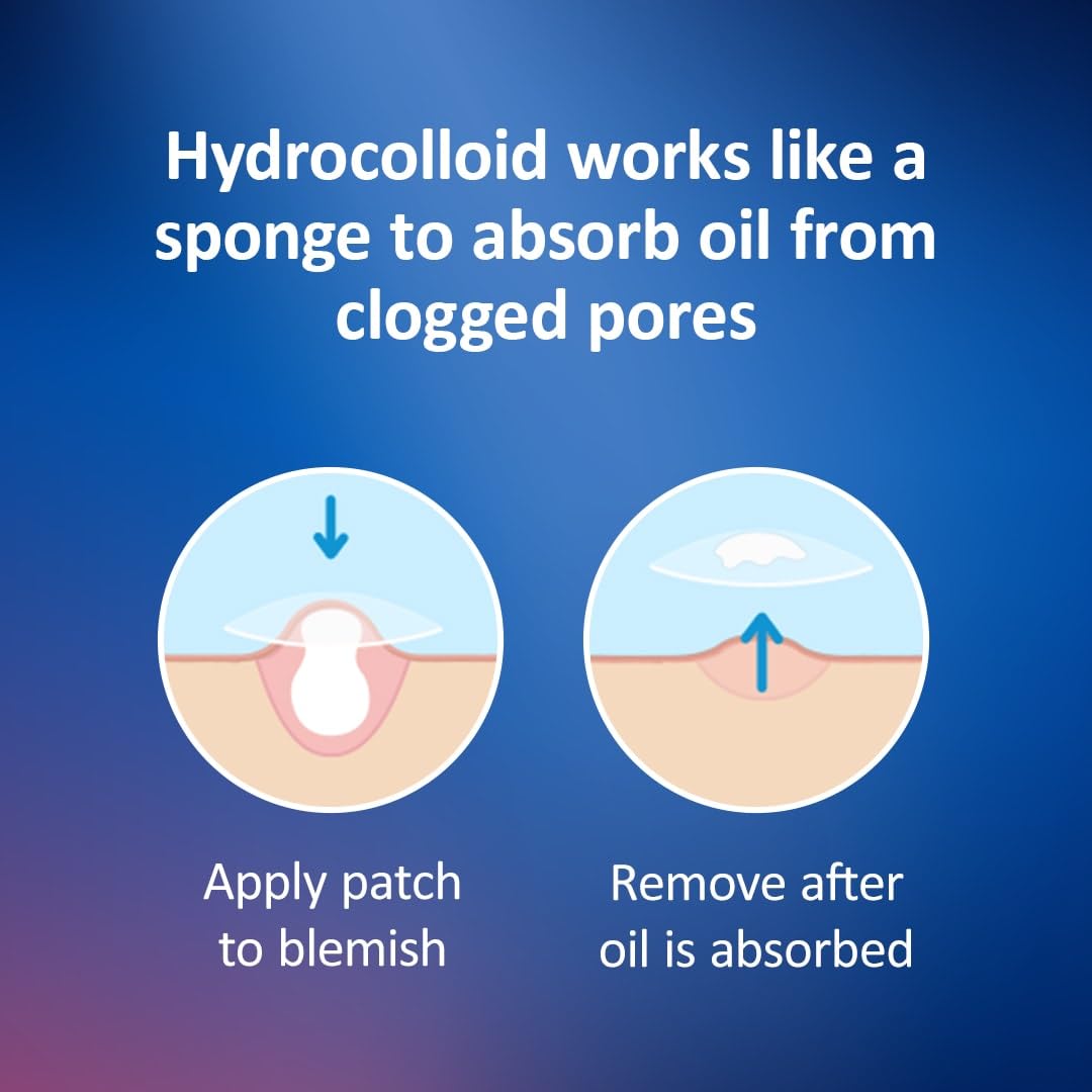 Nexcare hydrocolloid pimple patches in assorted sizes for targeted blemish care