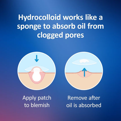 Nexcare hydrocolloid pimple patches in assorted sizes for targeted blemish care