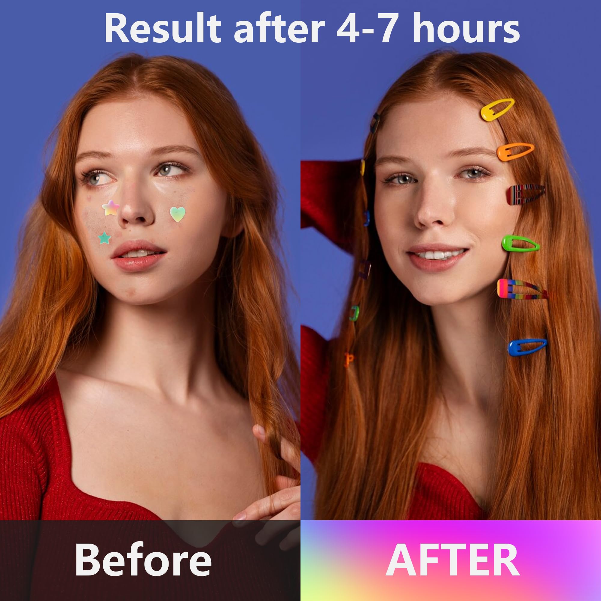 Close-up of acne spot stickers formulated with salicylic acid and centella asiatica for blemish care