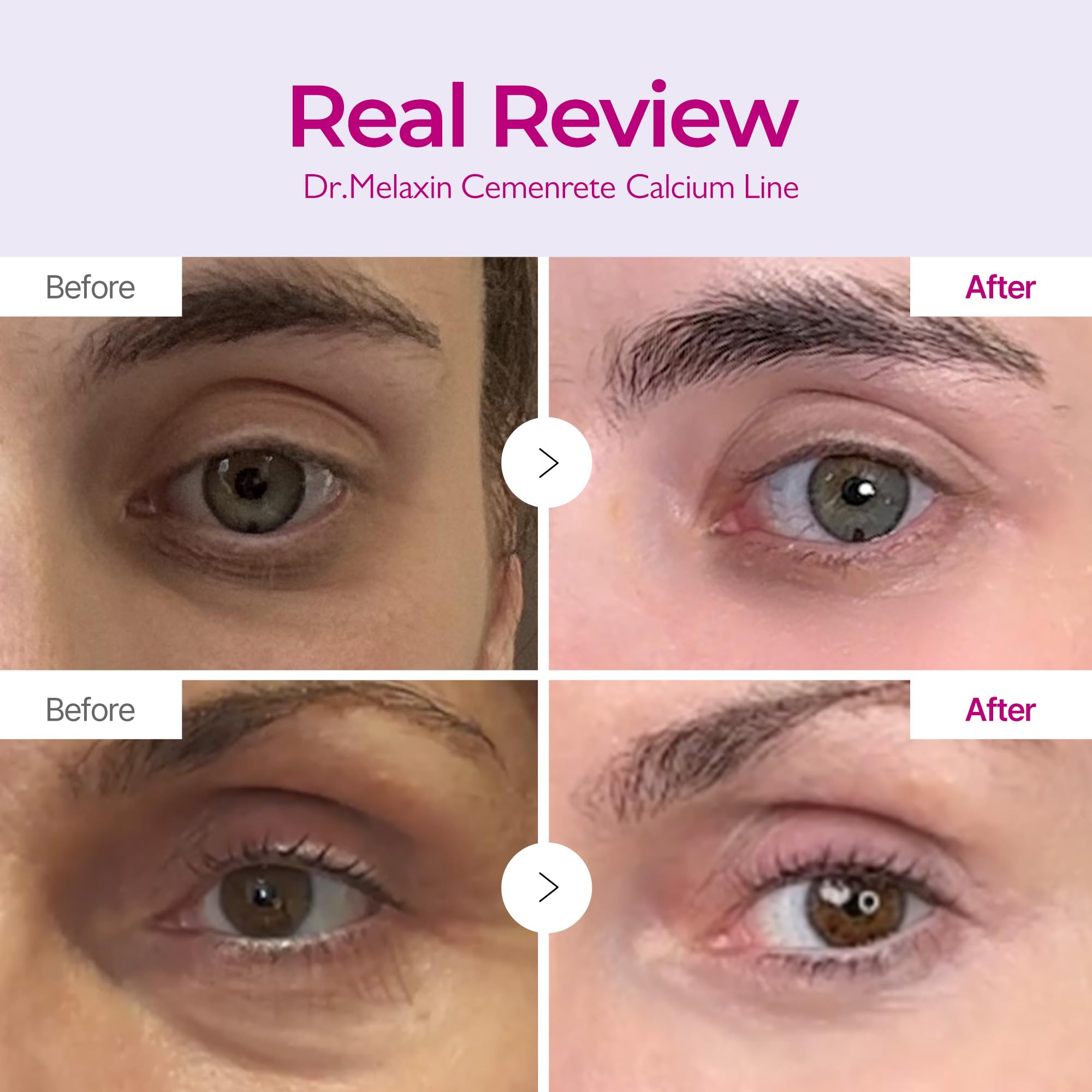 Texture shot of Dr.Melaxin Calcium Volume Cream showing rich concentrated non sticky formulation