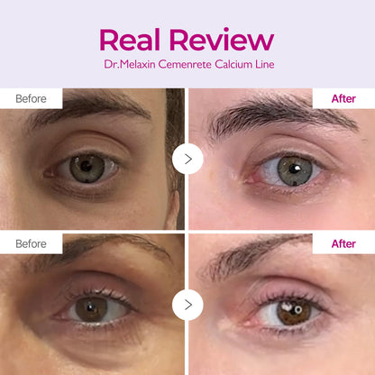 Texture shot of Dr.Melaxin Calcium Volume Cream showing rich concentrated non sticky formulation