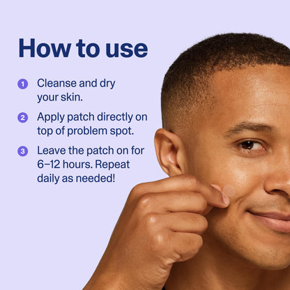 Curology emergency acne spot treatment stickers demonstrating oil and pus absorption