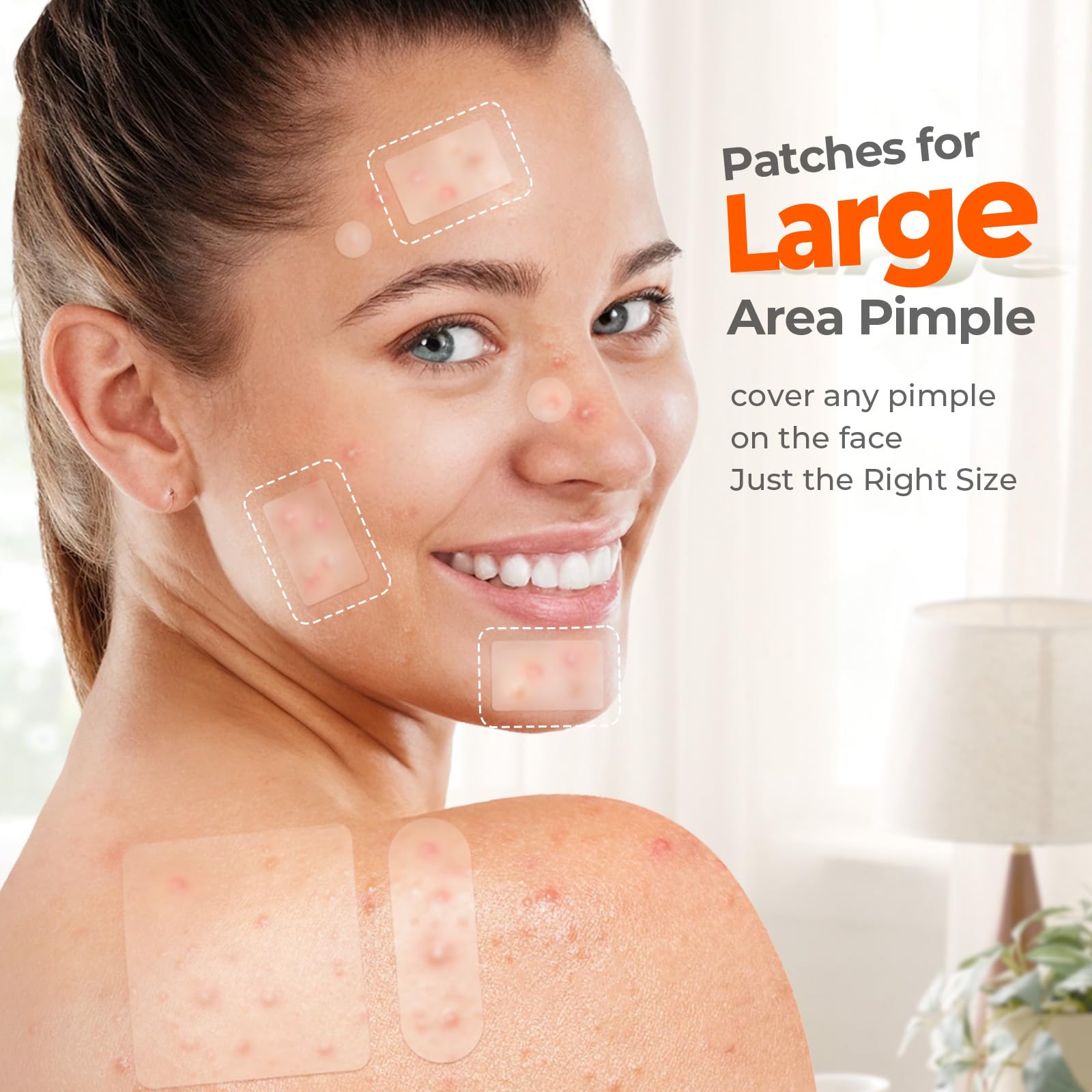 Tktk acne patches applied to forehead for blemish treatment