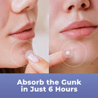 Tea tree oil infused hydrocolloid patch application display