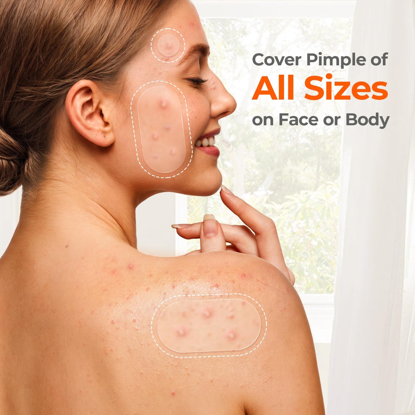 Before and after visualization using TKTK hydrocolloid blemish patches overnight for acne care.