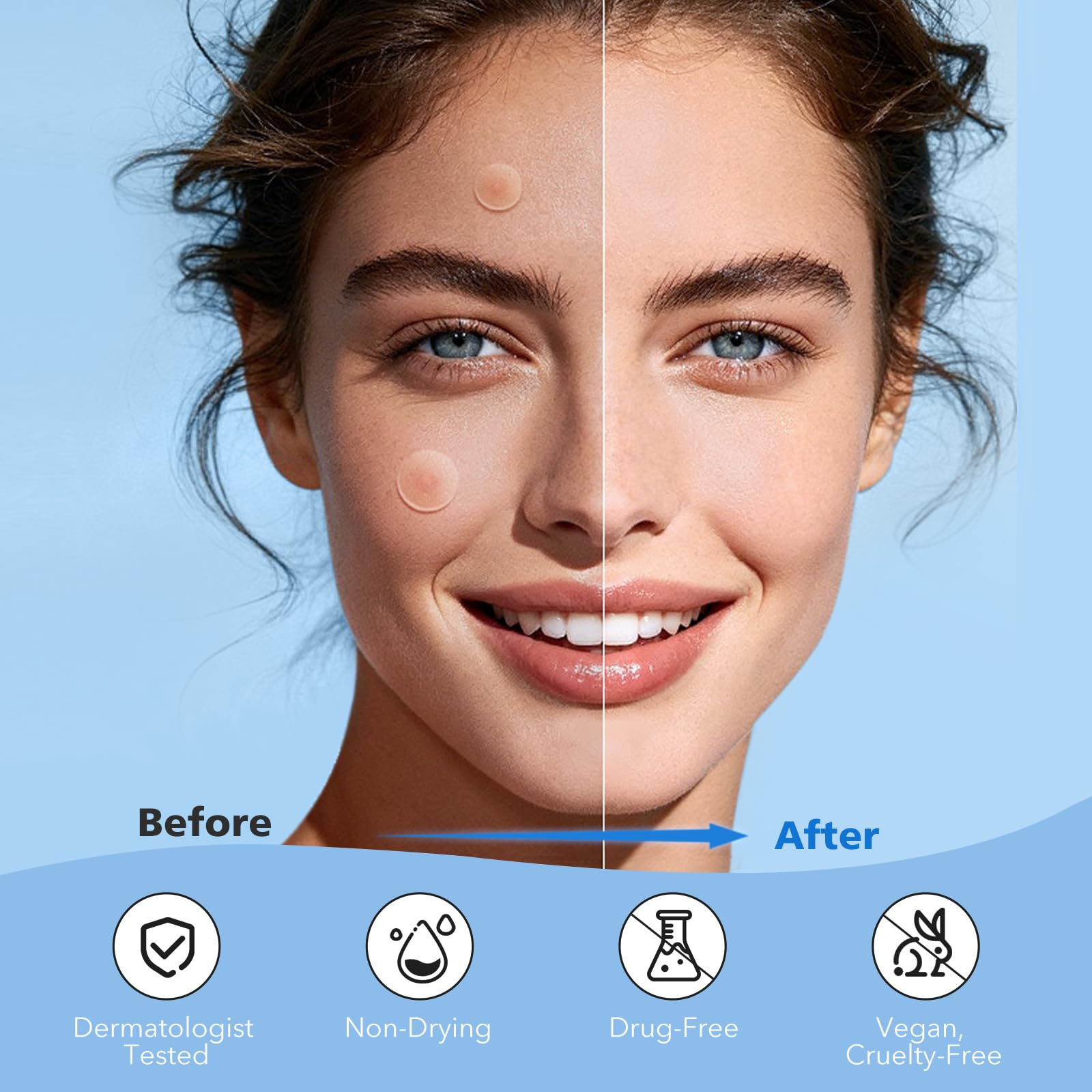QUSTERE pimple patches infused with tea tree oil and salicylic acid ingredients infographic