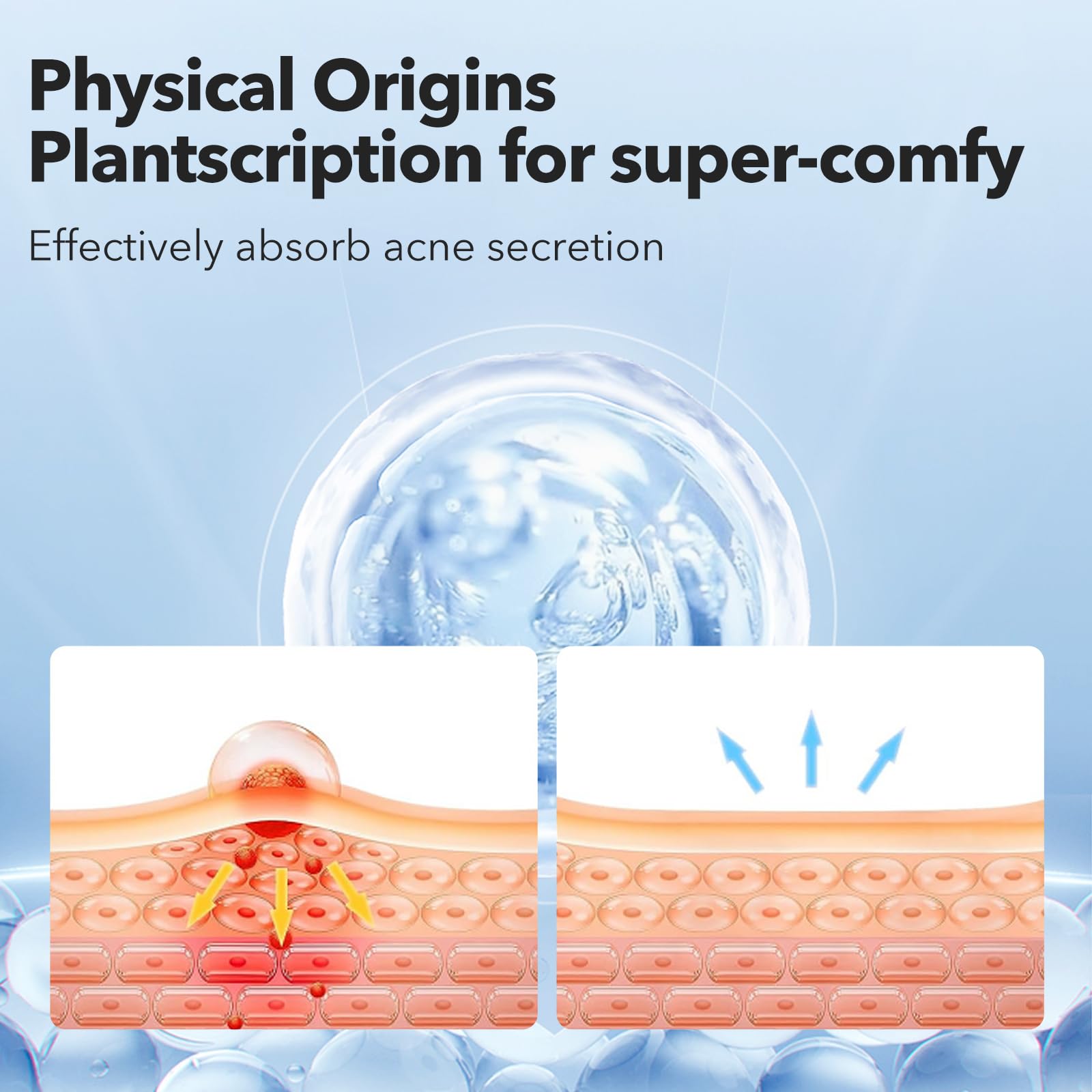 QUSTERE hydrocolloid patch absorbing impurities overnight from an active whitehead breakthrough