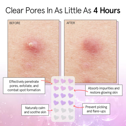 Dermatologist tested vegan hydrocolloid spot covers for breakouts.