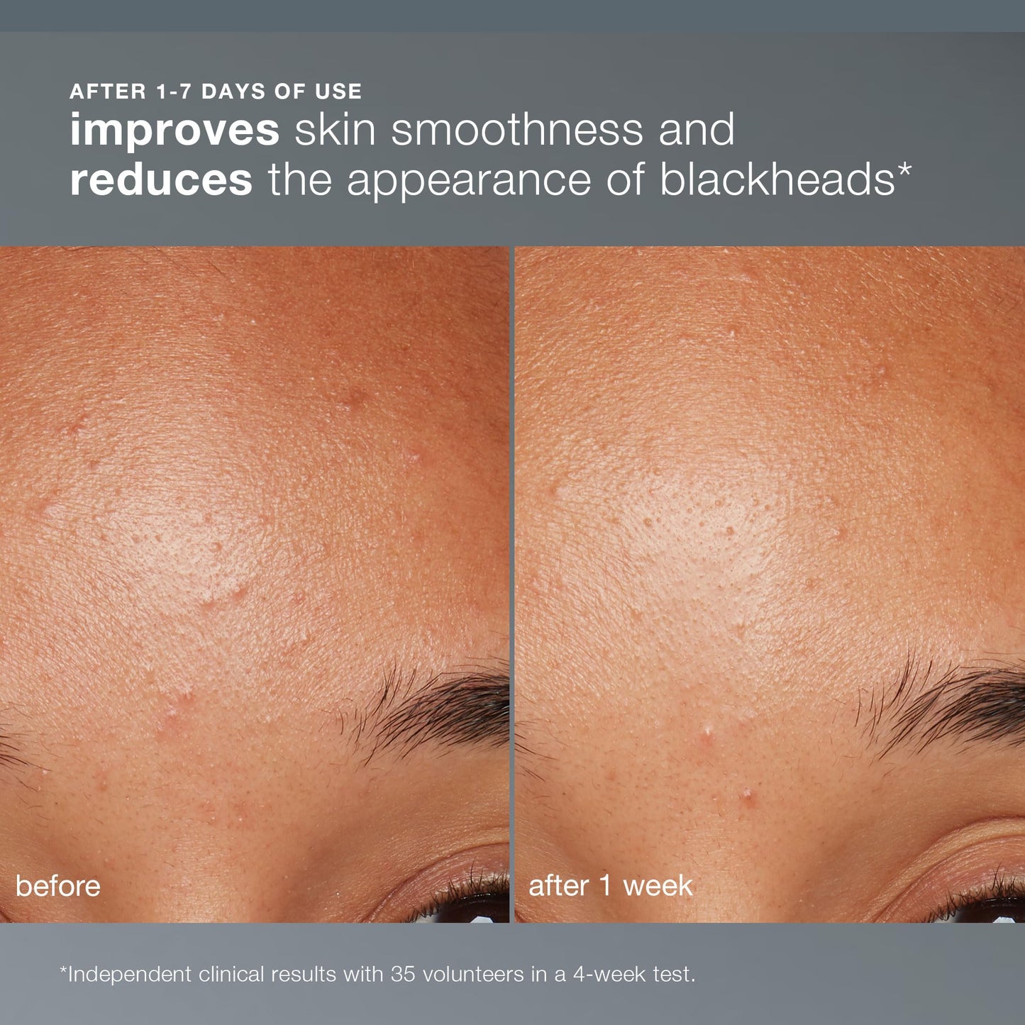 Dermalogica daily face scrub powder texture in hand.
