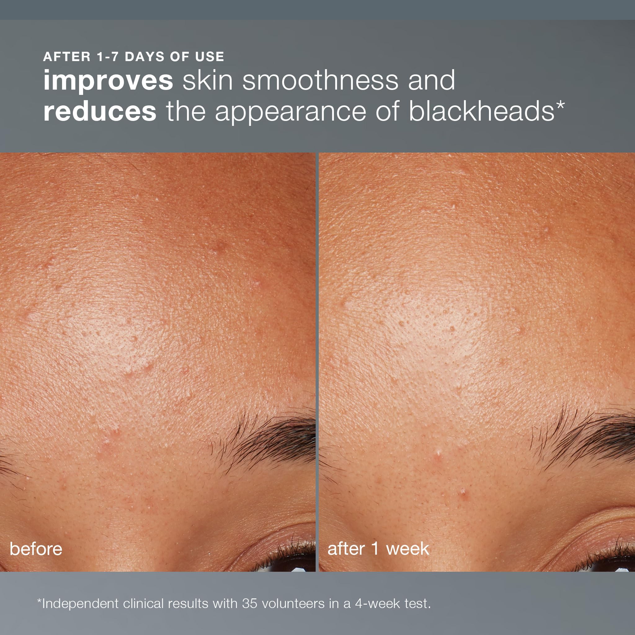 Dermalogica daily face scrub powder texture in hand.