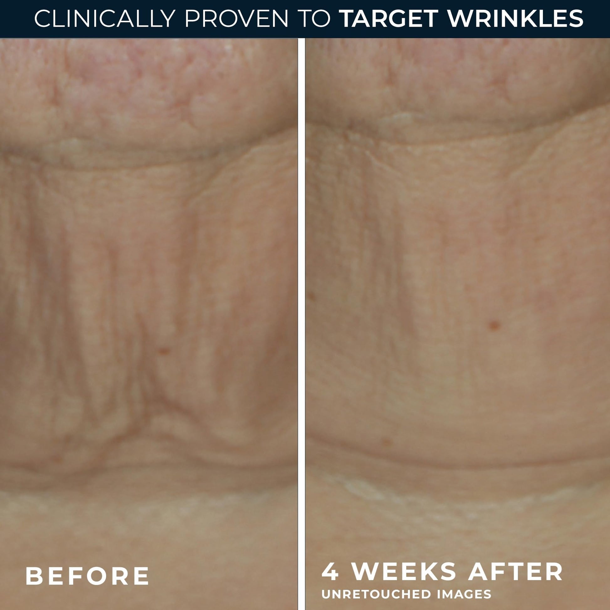 Twist-up application design of RoC Derm Correxion anti-aging retinol face stick.