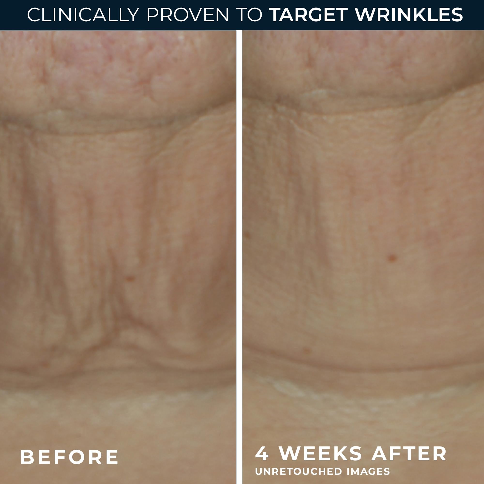 Twist-up application design of RoC Derm Correxion anti-aging retinol face stick.