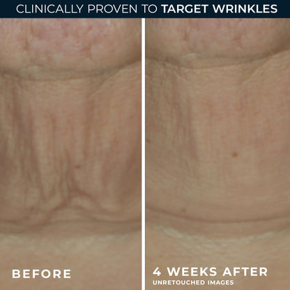 Twist-up application design of RoC Derm Correxion anti-aging retinol face stick.