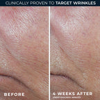 RoC Derm Correxion Retinol Firming Serum Stick side profile box view