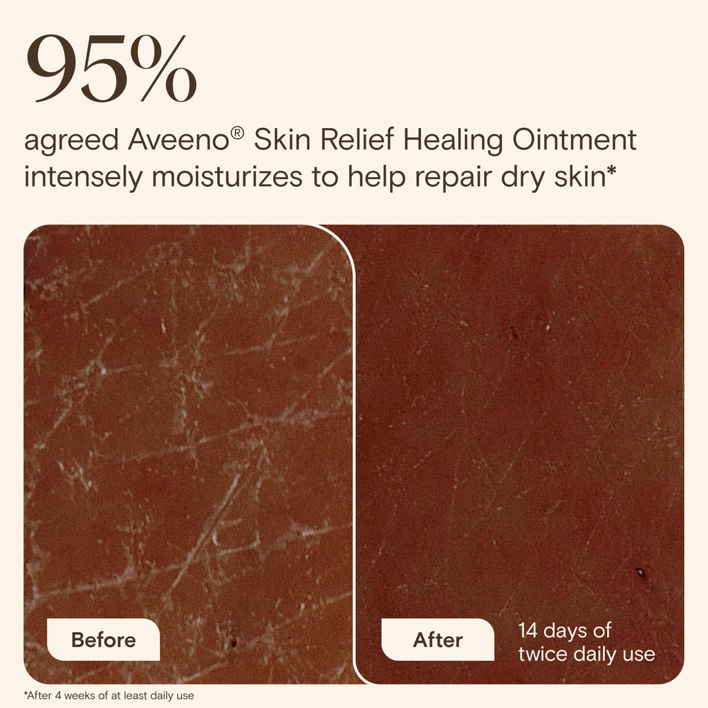 Authentic USA imported Aveeno skin relief ointment label demonstrating the 7.2 ounce size
