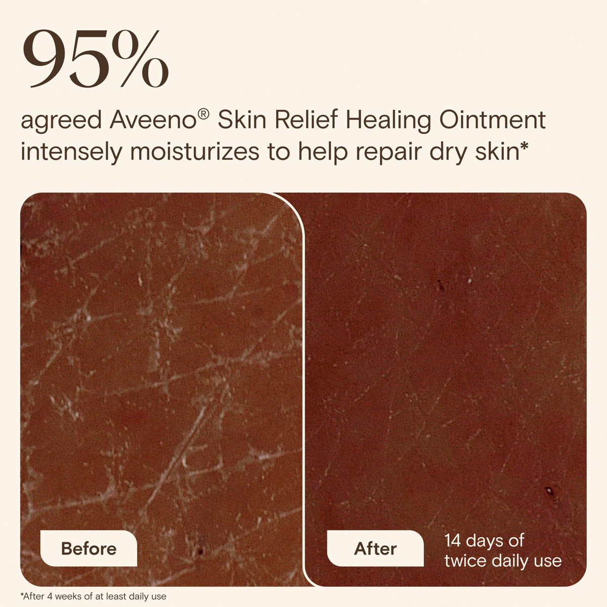 Authentic USA imported Aveeno skin relief ointment label demonstrating the 7.2 ounce size