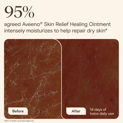 Authentic USA imported Aveeno skin relief ointment label demonstrating the 7.2 ounce size