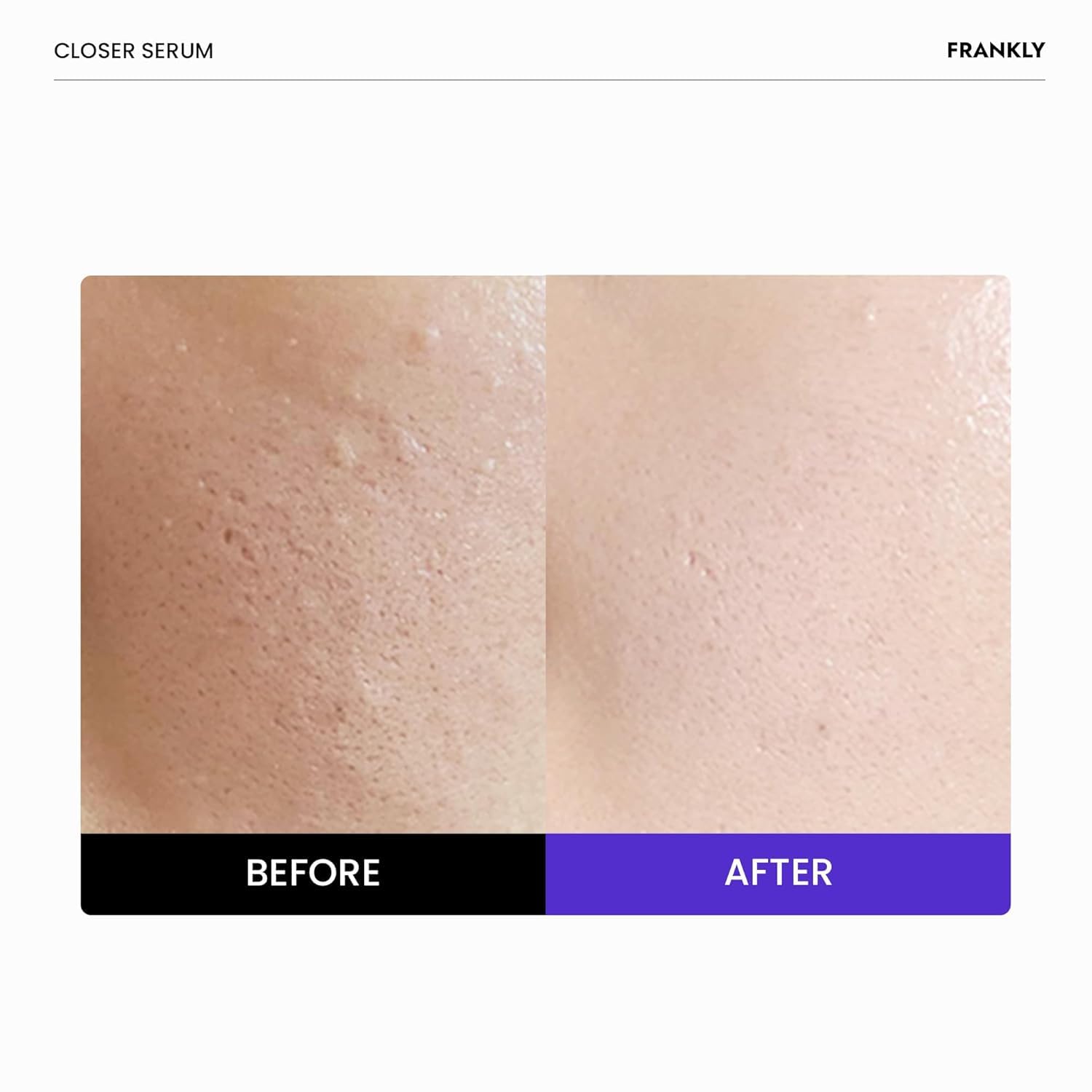 Frankly Closer Serum packaging showcasing the nine peptides and vegan collagen ingredients