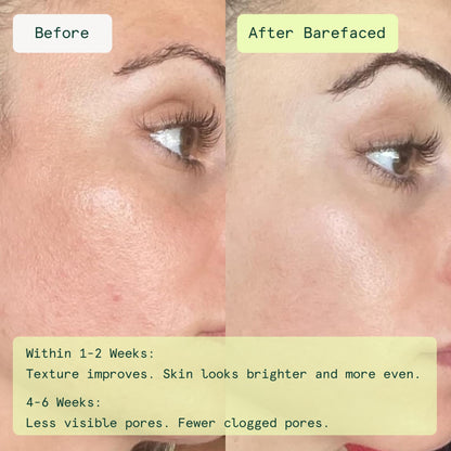 Barefaced exfoliating face pads with glycolic acid packaging details
