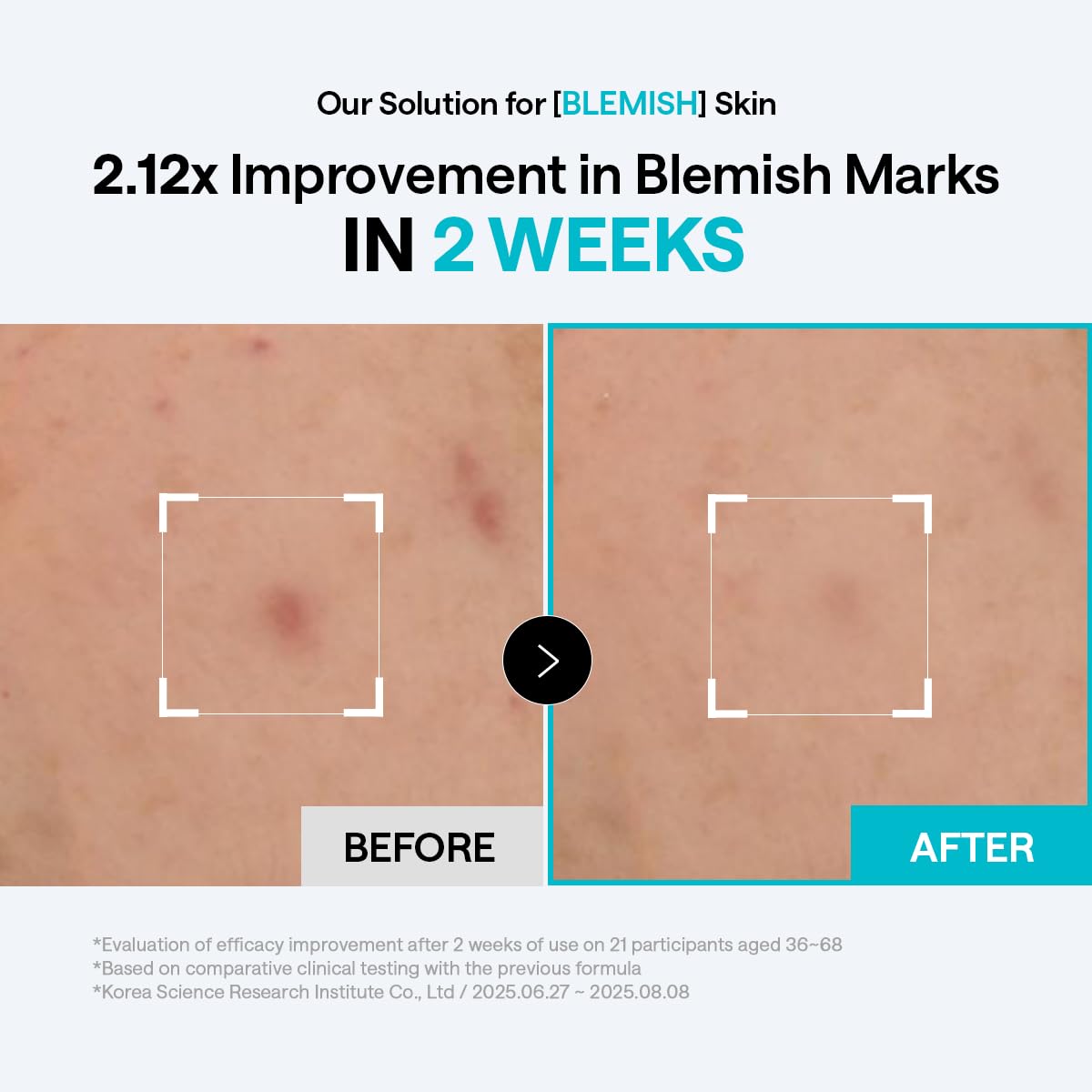 Mediheal Madecassoside Blemish Pad box packaging listing Centella Asiatica ingredients