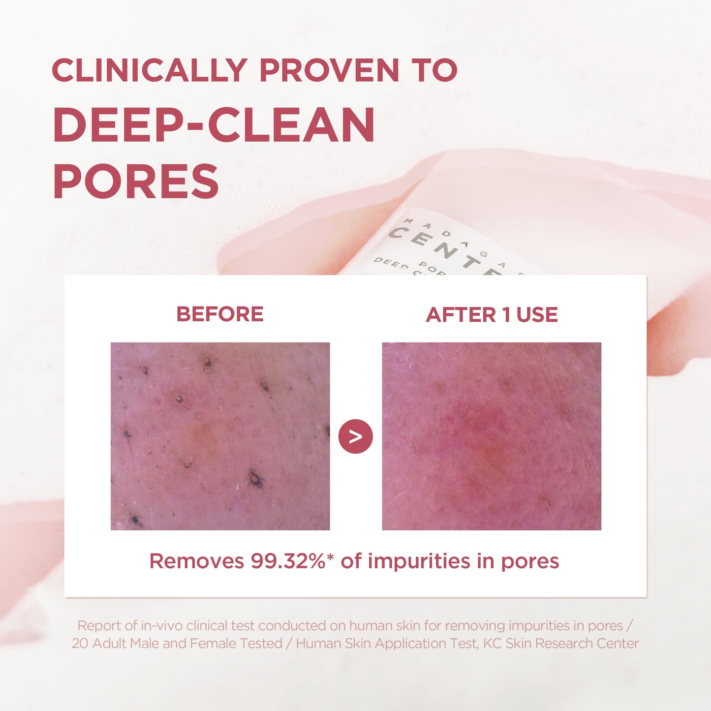 SKIN1004 cleanser foam lathered on hand for demonstration.