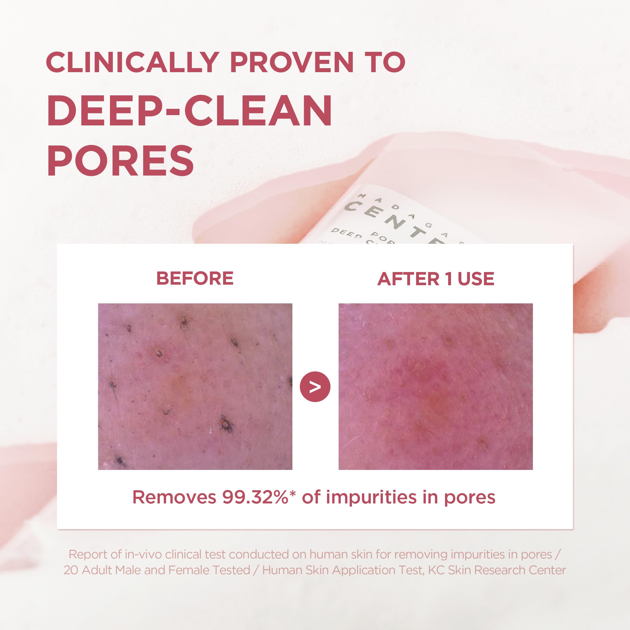 SKIN1004 cleanser foam lathered on hand for demonstration.