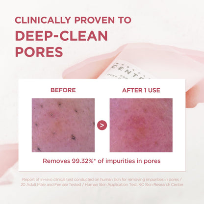 SKIN1004 cleanser foam lathered on hand for demonstration.