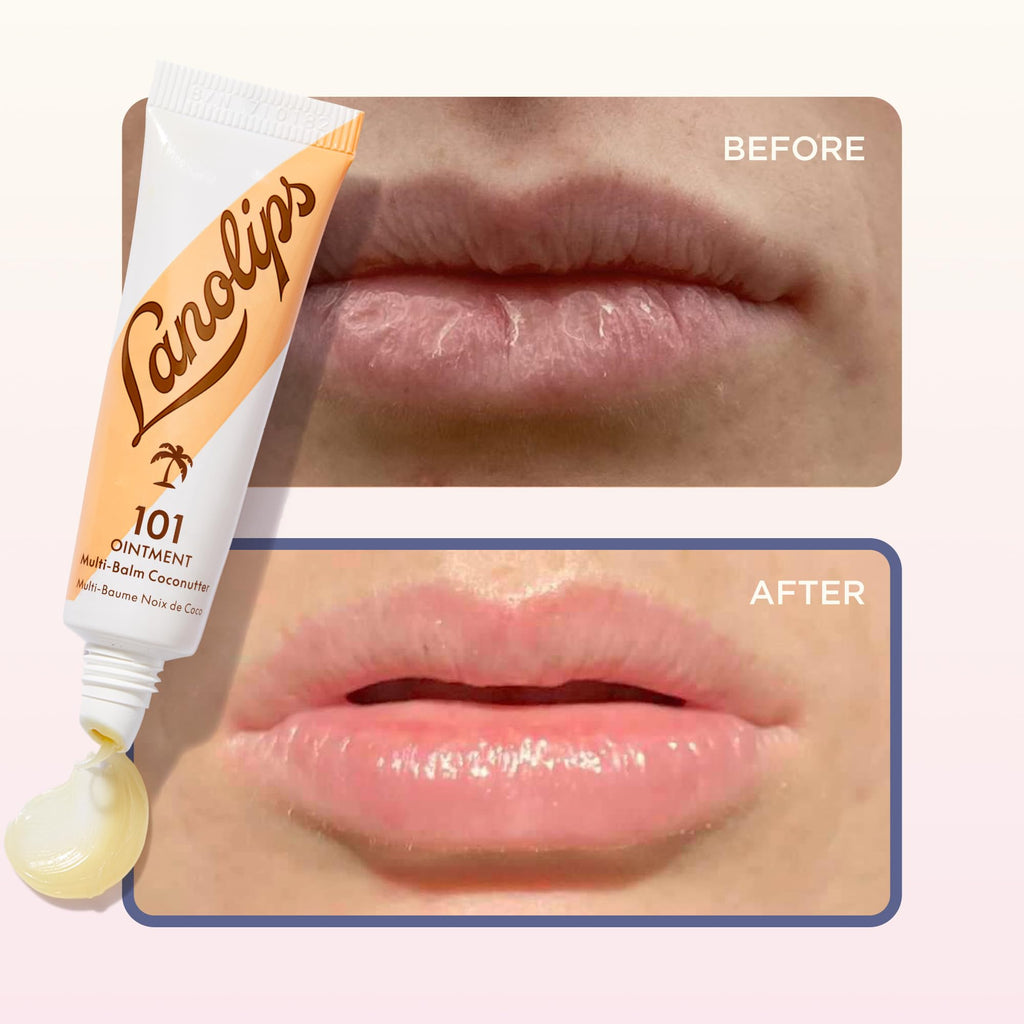 Demonstration of the Lanolips Coconutter balm being applied to dry skin for hydration.