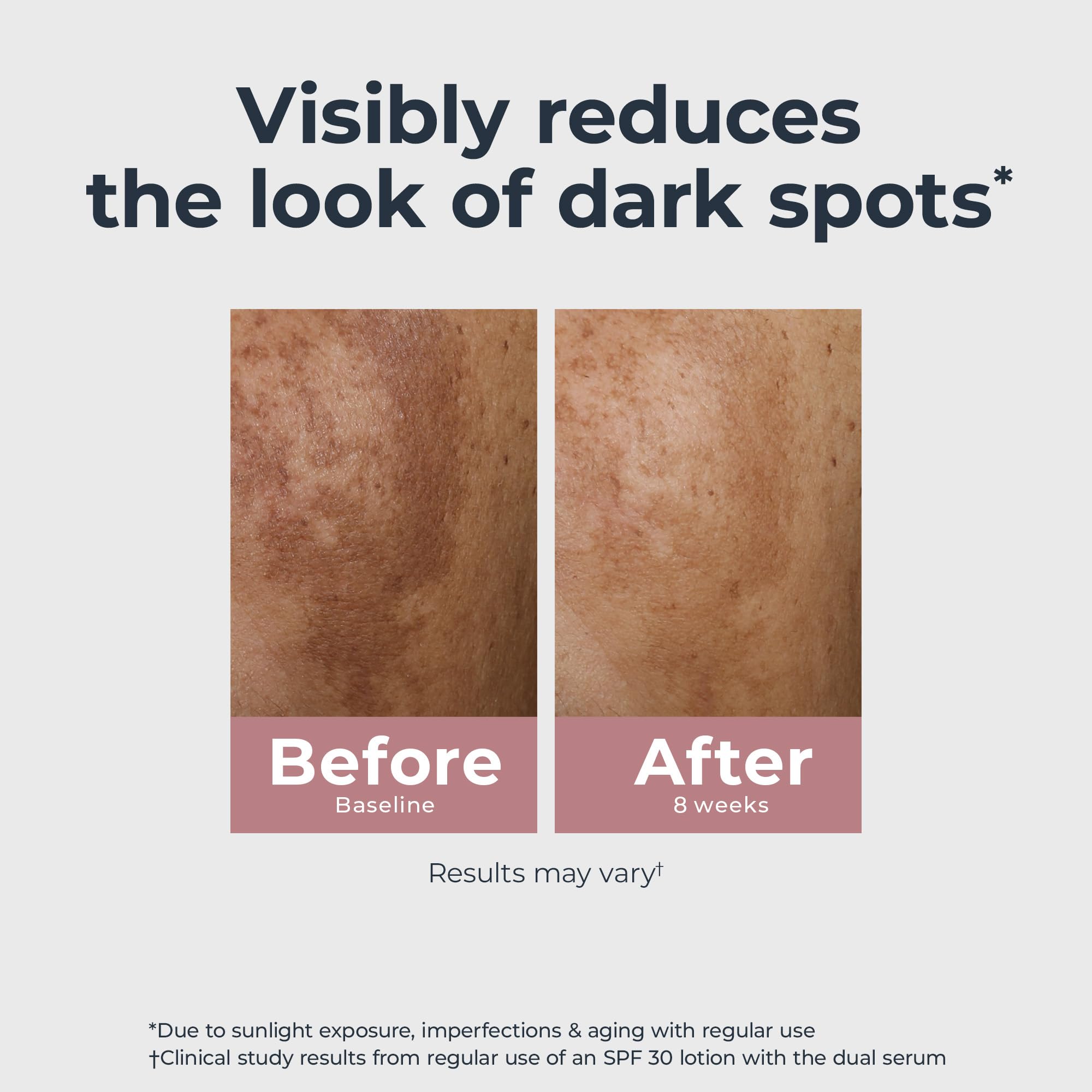 Eucerin radiant tone skincare serum for evening skin tone