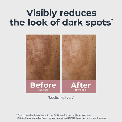 Eucerin radiant tone skincare serum for evening skin tone