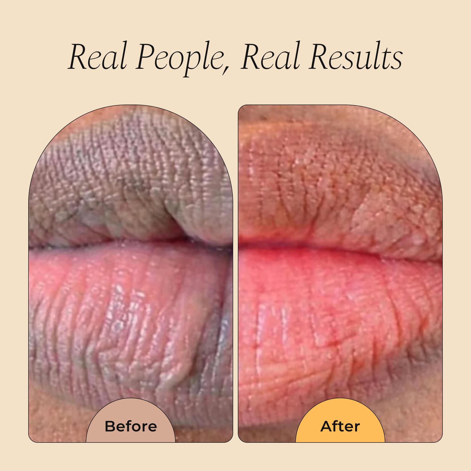 Natural lemon and turmeric lip balm for smokers lips
