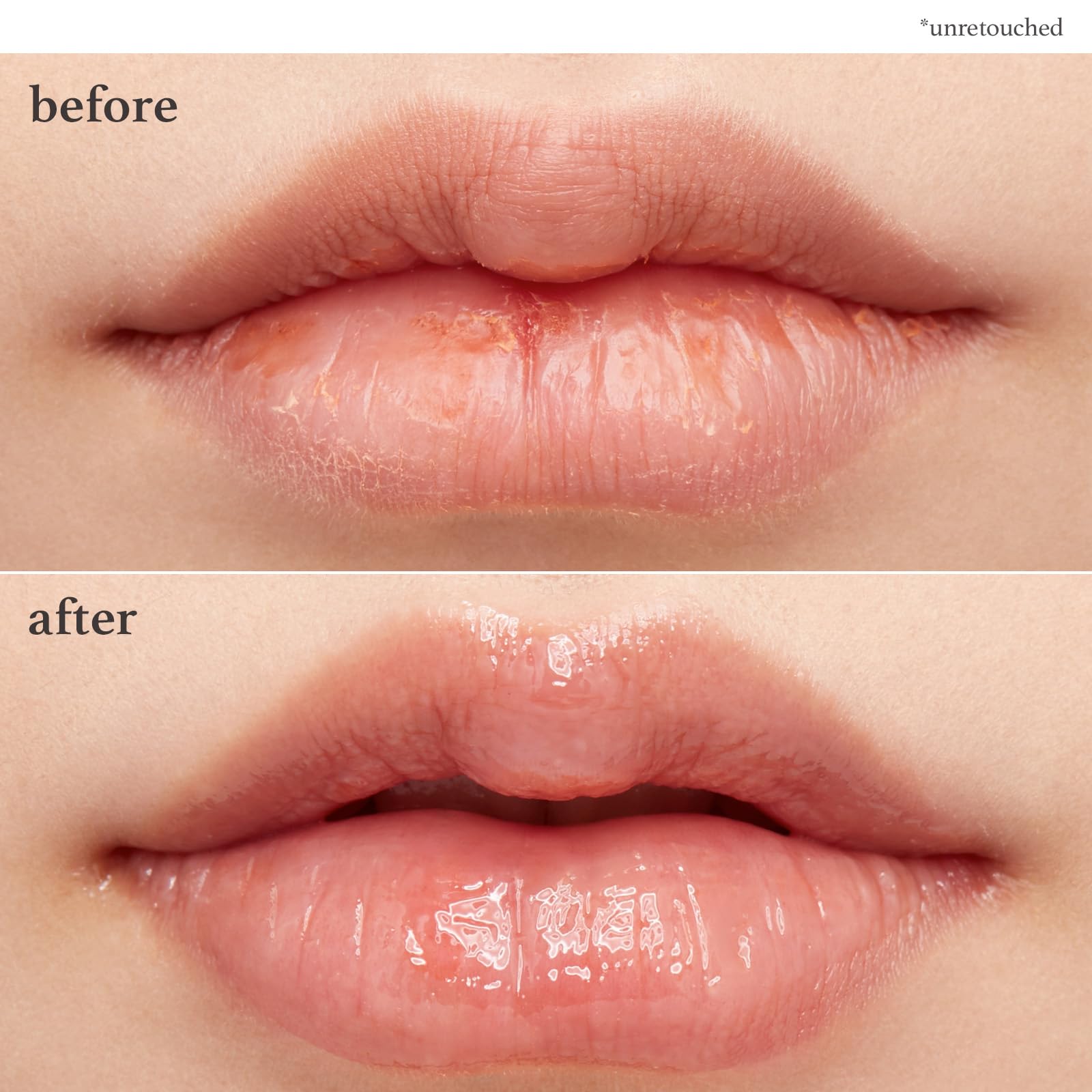 Nooni Applebutter lip treatment packaging