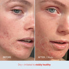 First Aid Beauty Ultra Repair Cream applied on dry hand skin showing fast absorption.
