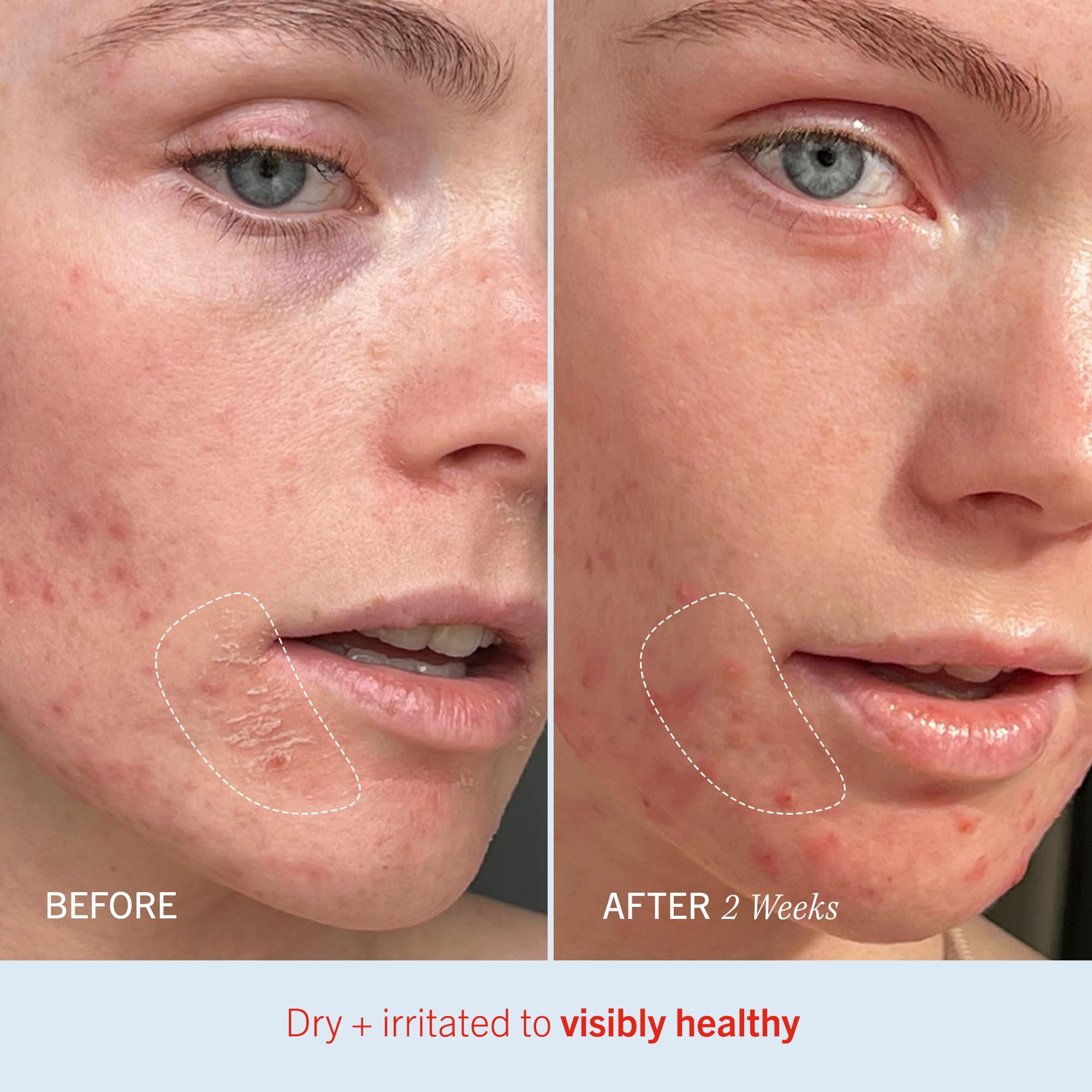 First Aid Beauty intense hydration moisturizer skin protectant packaging